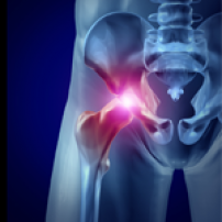 hip-arthroscopy hip-arthroscopy